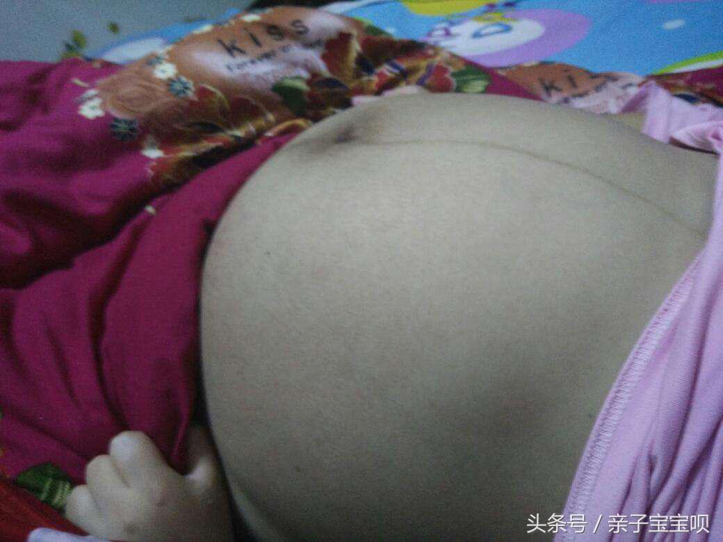 怀孕八个月忽然早产，胎儿“伸手”求救被拒，医生怒斥婆婆太狠心