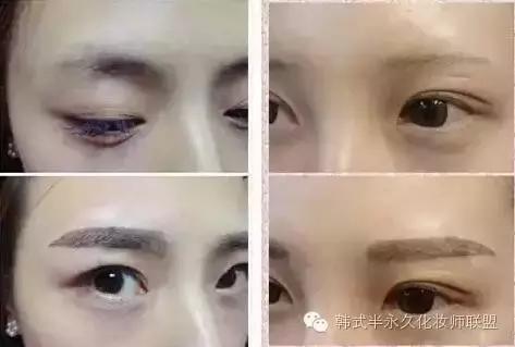 眉毛掉色什么原因,眉掉色