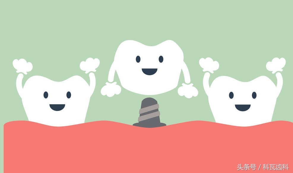 青少年适合种植牙还是假牙,缺牙活动假牙修复