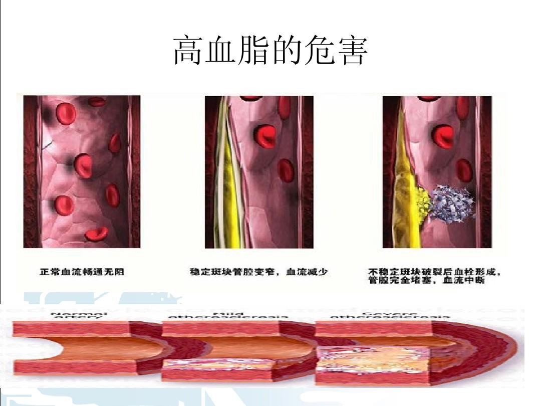 高血脂高胆固醇的危害有哪些,高血脂能吃核桃吗有什么危害