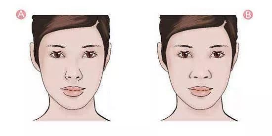 「爱美」双眼之间“一片荒芜”，鼻子一塌毁所有啊！