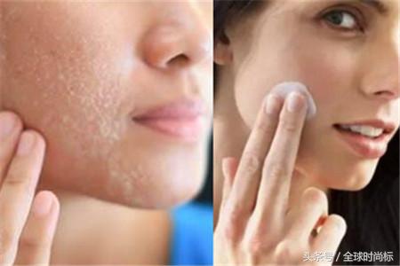 如何清洁毛孔里的脏东西,清洁脸部毛孔脏东西全过程