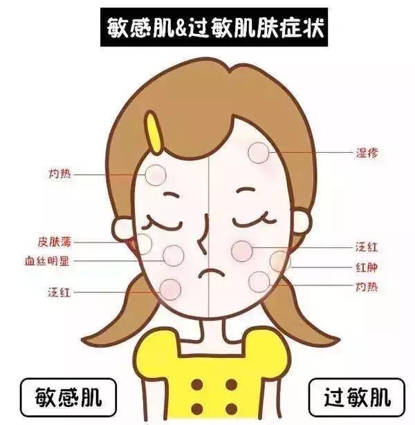敏感肌冬季护理小常识,敏感肌的春季防敏攻略来咯