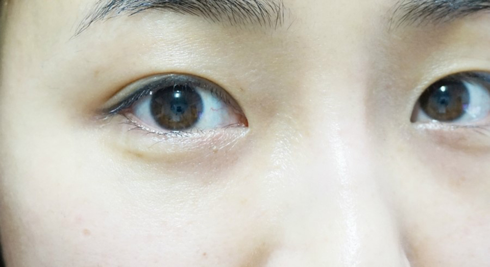 脸上干燥起皮怎么样才能快速补救,化妆干燥起皮