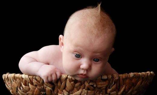 宝宝皮肤冬天皲裂小妙招,宝宝皮肤皲裂图片