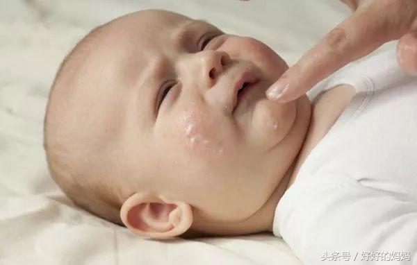 湿疹神药,被炒到2千多的药