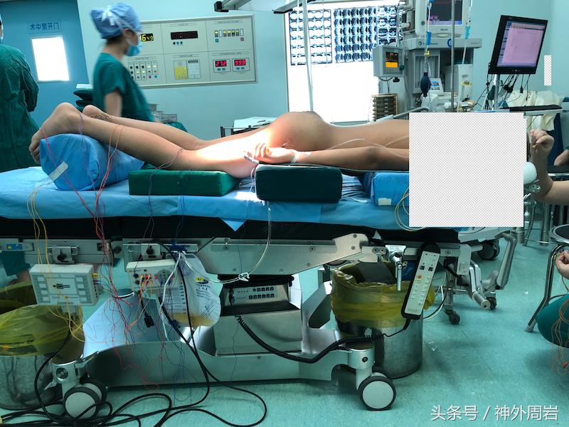 婴幼儿腰骶部有包块，这是神经疾病，会造成致命性的肾损害