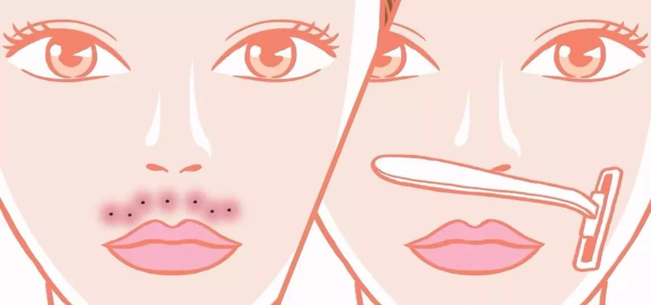 今日颜值主题：女汉纸的痛你们不懂，烦心的小胡子其实很容易去除