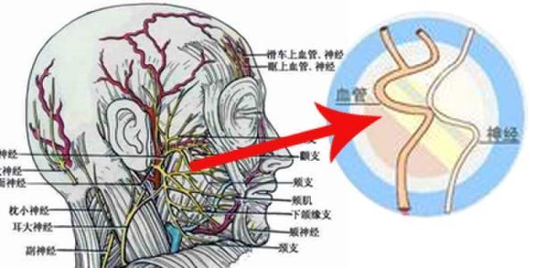 冷热交替吃东西补救办法,受凉嘴歪恢复期需要吃药吗