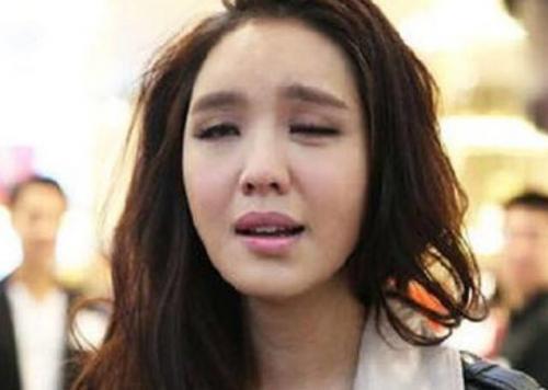 冷热交替吃东西补救办法,受凉嘴歪恢复期需要吃药吗