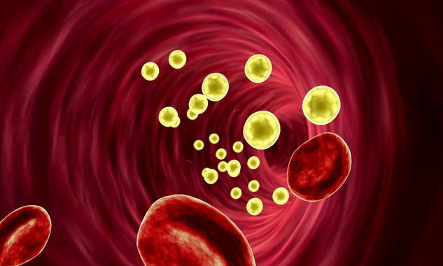 血脂检查甘油三酯3.3严重吗,血脂的检查甘油三酯高其余都正常