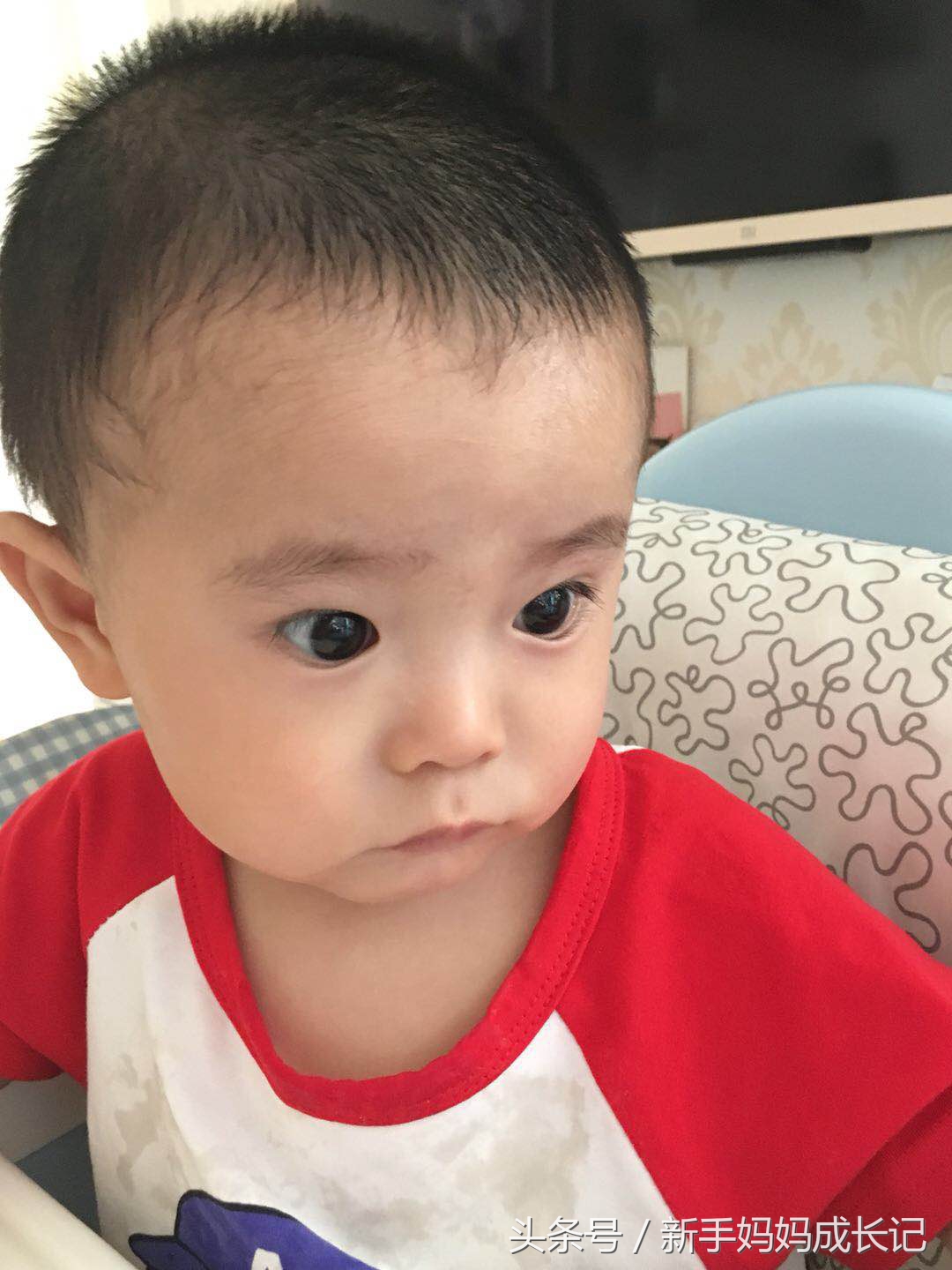 宝宝湿疹的样子有哪些,宝宝湿疹的前期症状是怎样的