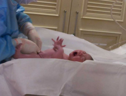 为什么女人顺产比剖腹产更容易,为什么现在顺产要侧切