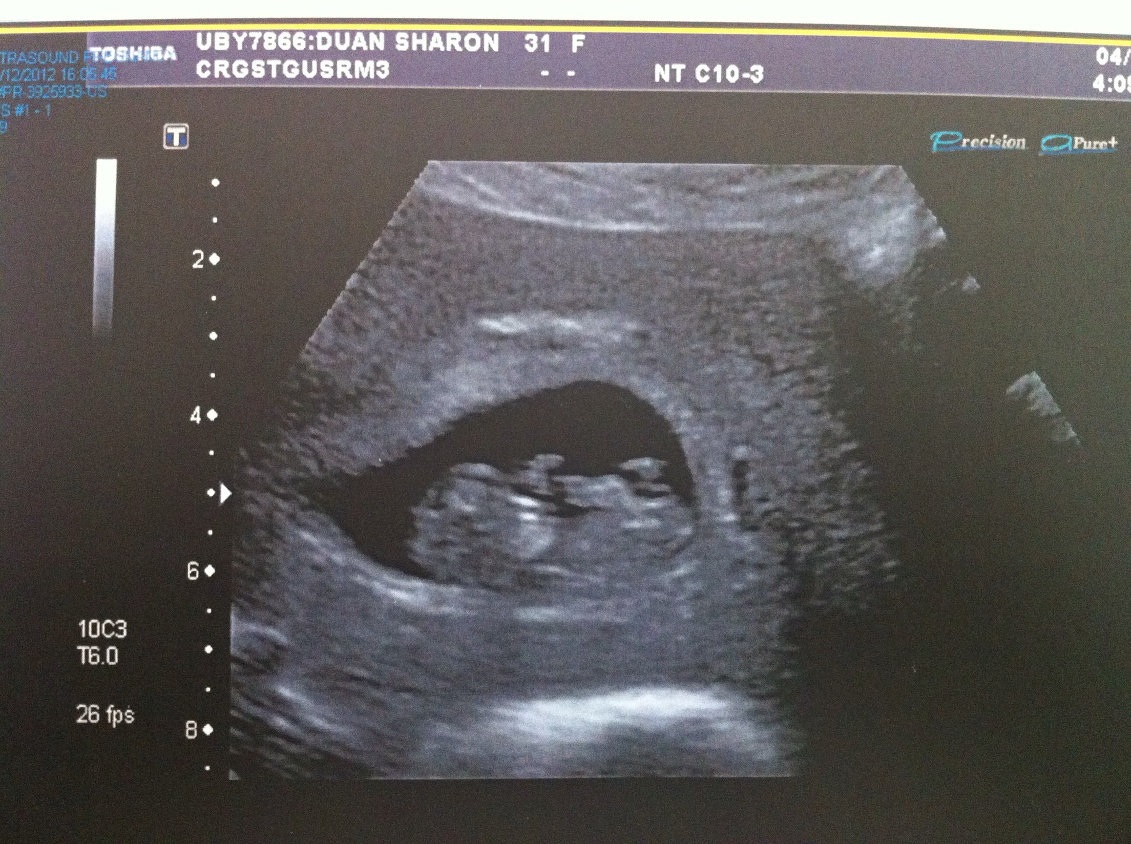 一日为母终生坚不可摧，全世界却为你流眼泪！