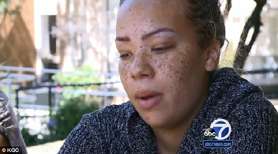 宝宝哭闹不休怎么办？爸爸咬掉儿子的鼻子