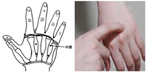 肩颈疼按摩手上的哪个穴位,肩颈酸胀手臂酸胀按什么穴位