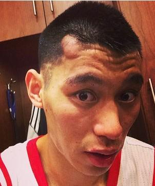 脑袋摔了个大包可以跑步吗,跑步磕到后脑勺一个包