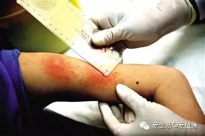 海苔可以抗癌,海苔可以抗癌吗