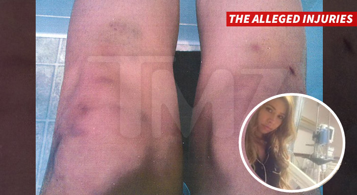 35岁的《欢乐合唱团》男星上吊自杀，是谁逼死了他？