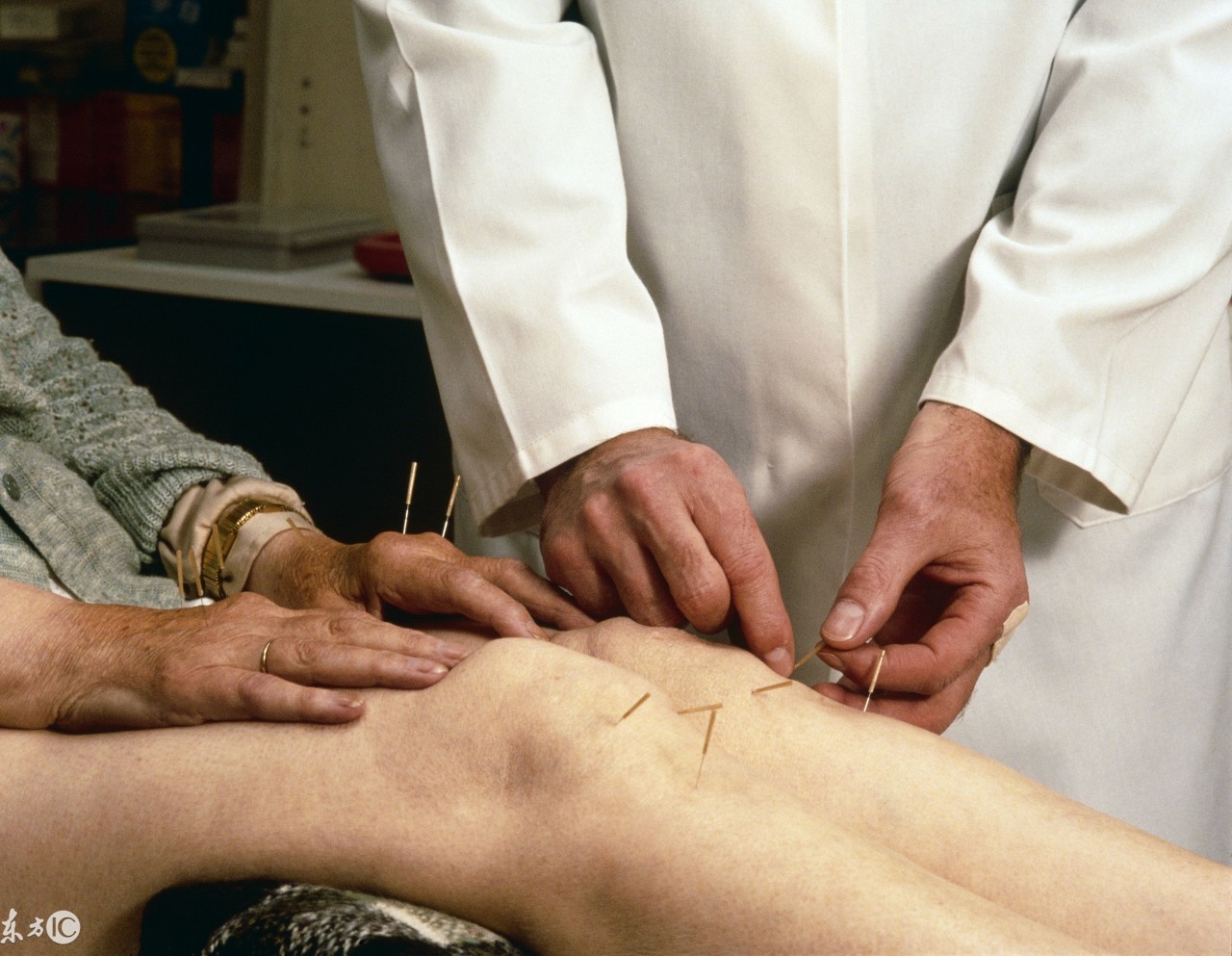 刘红云风湿性关节炎针灸穴位,刘红云针灸治疗风湿性关节炎