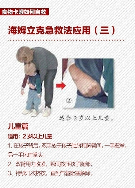 大人异物卡在喉咙妙招,孩子被异物卡喉怎么处理才靠谱