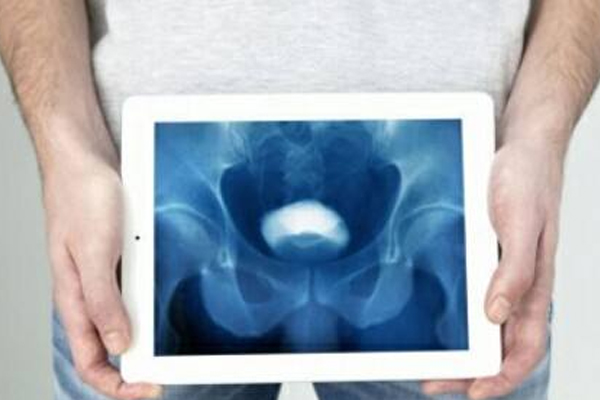 台湾林口长庚质子治疗怎么样,质子治疗肿瘤最新方法