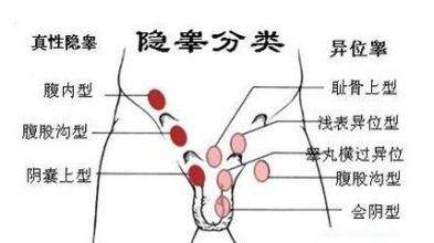 男人“蛋蛋”越大越好？谨慎这几种病！
