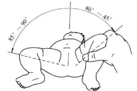 宝宝臀纹不对称有必要打b超吗,宝宝臀纹不对称做b超