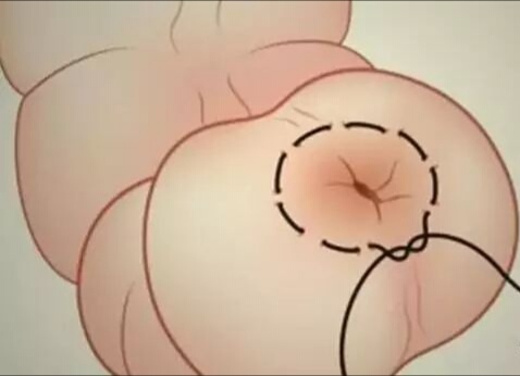 不要小瞧身上任何小毛病,现在大批猪死的是什么病