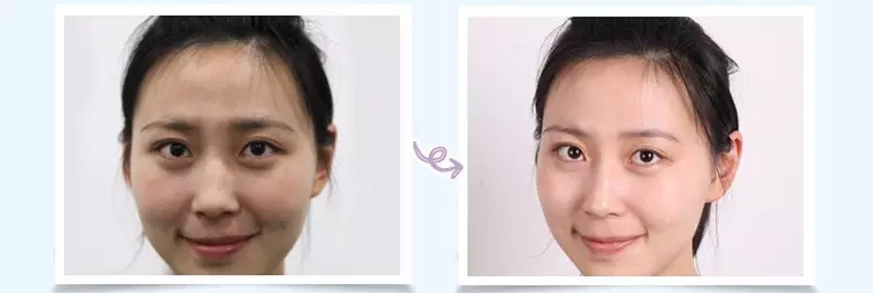 兰芝隔离使用测评李佳琦,兰芝雪纱丝柔隔离