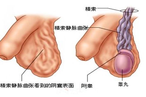 男人“蛋蛋”越大越好？谨慎这几种病！