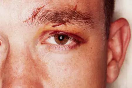 男士眼部补水抗皱去黑眼圈,男士护肤去皱纹去黑眼圈