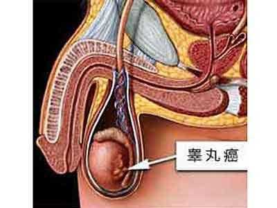 男人“蛋蛋”越大越好？谨慎这几种病！