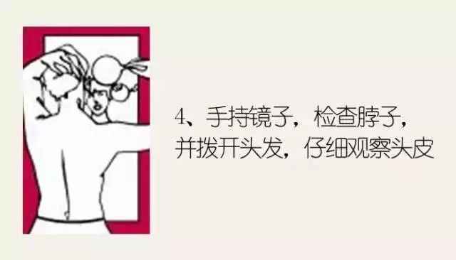 黑色素痣病理检测鳞状上皮病变,什么样的痣需要做病理