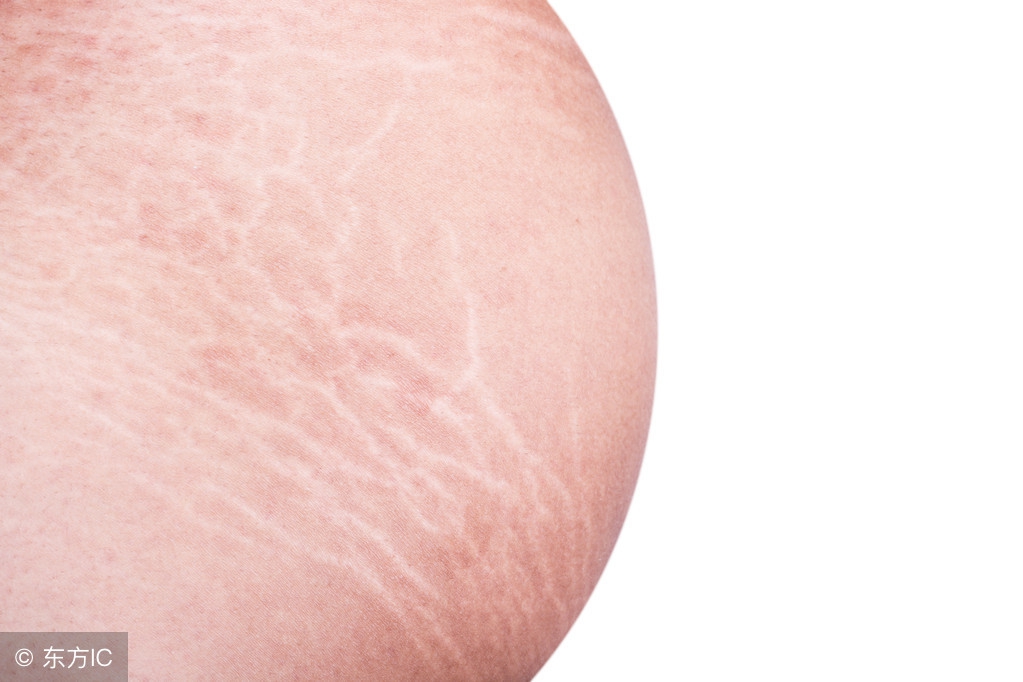 遗传性鱼鳞病怎么治疗,遗传性鱼鳞病能治好吗