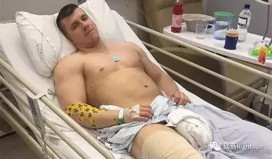 健美冠军体脂率是多少,26岁健美冠军小腿静脉爆裂