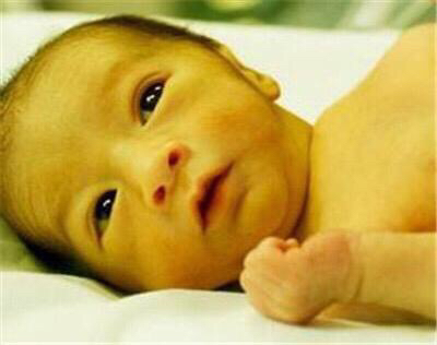 益生菌对新生儿黄疸的作用是什么,新生儿黄疸吃益生菌十几次好