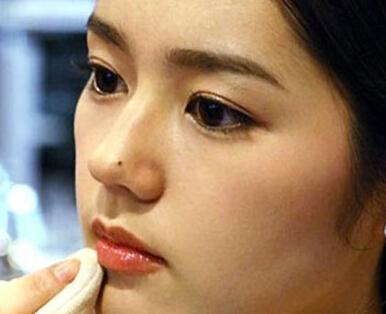 黑色素痣病理检测鳞状上皮病变,什么样的痣需要做病理