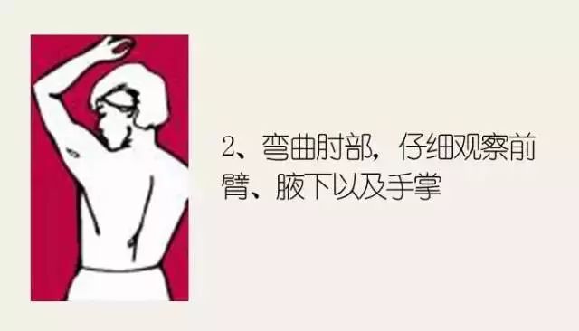 黑色素痣病理检测鳞状上皮病变,什么样的痣需要做病理