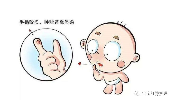 宝宝皮肤干燥起皮是湿疹吗,宝宝皮肤干燥起皮是缺什么吗