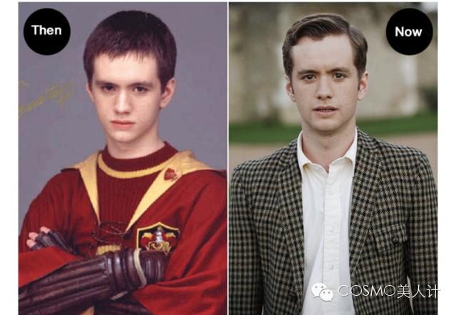 断发脱发怎么救,断头发该怎么护理