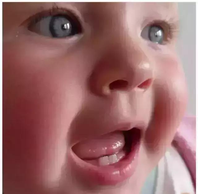 婴幼儿保护牙齿的十个小常识,婴儿牙齿护理十大禁忌