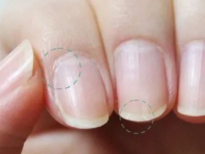 小指甲特别小,小指甲小到什么程度