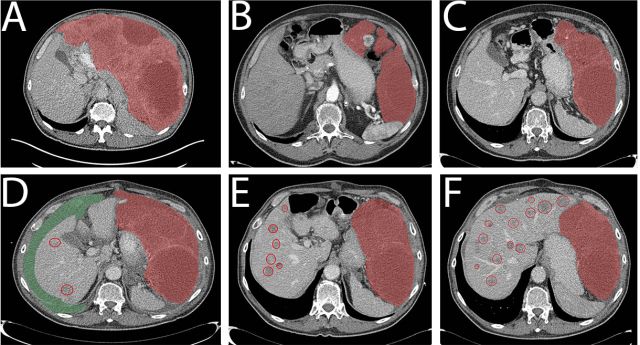 pubmed综述论文,pubmed文献全文