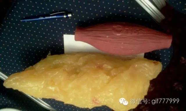 10张图看清人生真相,一张图看懂脂肪多可怕