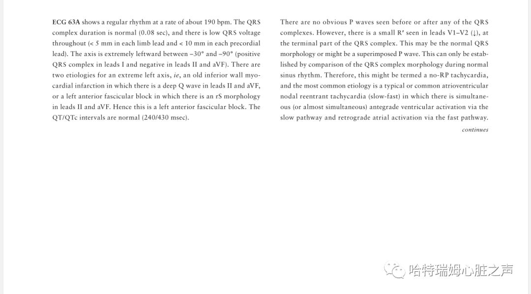 「读心有术」329期：电轴极度左偏，病因有两种