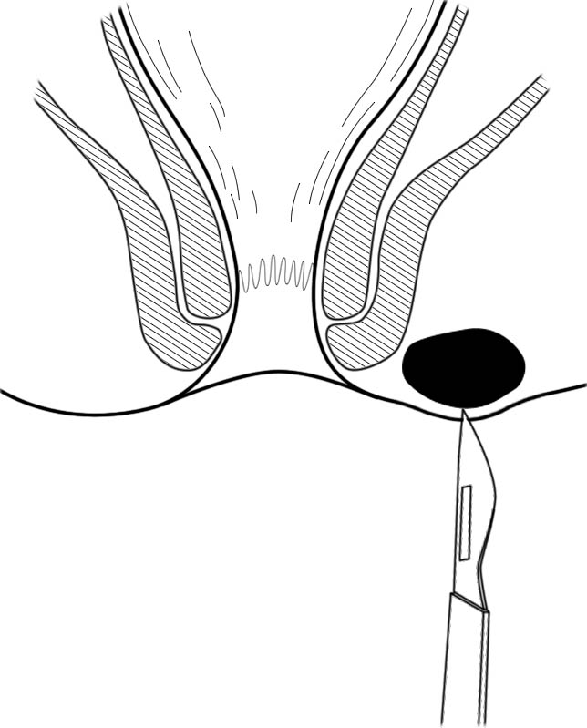 肛肠最新技术,人活一世难免会遇到各种糟心的事