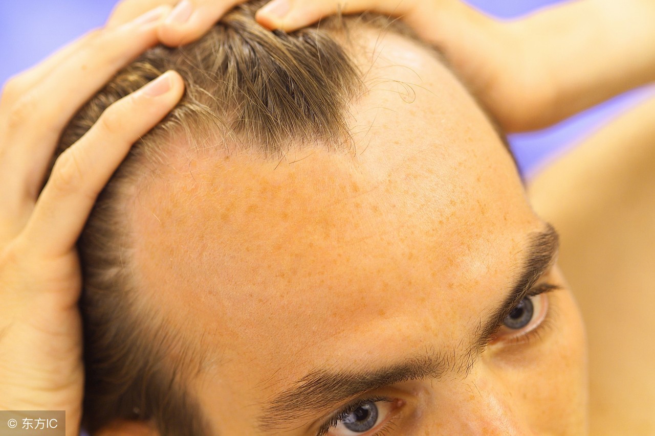 养血生发胶囊可以改善白头发吗,养血生发胶囊刚开始用会掉发吗