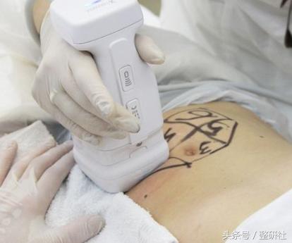 医美助力逆转修复,医美可以抵抗断崖式衰老吗