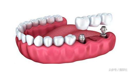 医美助力逆转修复,医美可以抵抗断崖式衰老吗